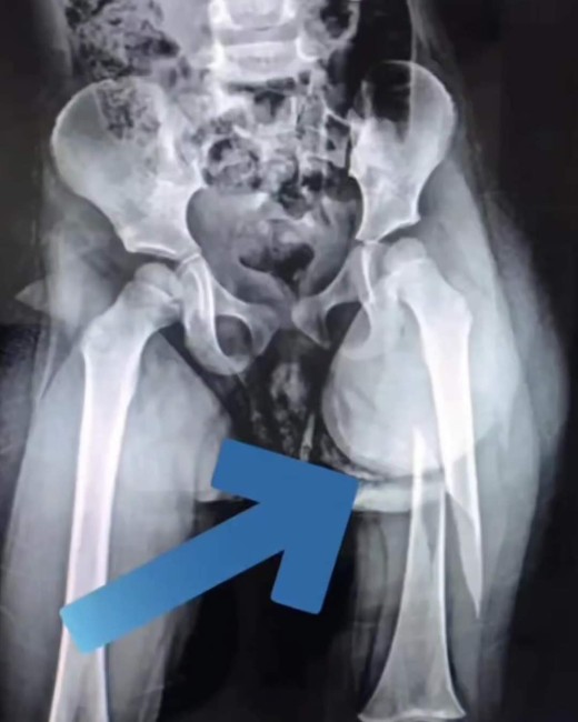 FB IMG 1699361285276